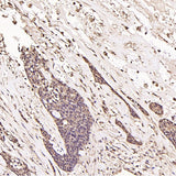 Anti-Ubiquitin UBB Rabbit Monoclonal Antibody Boster Bio