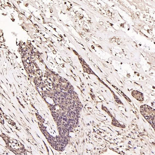Anti-Ubiquitin UBB Rabbit Monoclonal Antibody Boster Bio