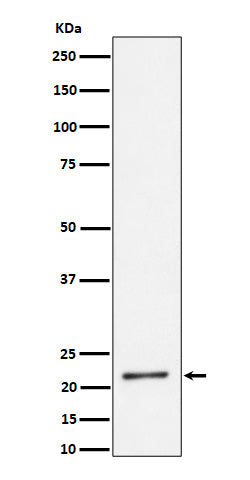 Anti-K27-linkage Specific Ubiquitin Rabbit Monoclonal Antibody Boster Bio