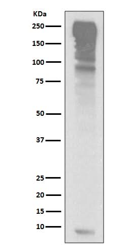 Anti-Ubiquitin UBB Rabbit Monoclonal Antibody Boster Bio