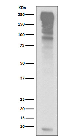 Anti-Ubiquitin UBB Rabbit Monoclonal Antibody Boster Bio