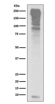 Anti-Ubiquitin UBB Rabbit Monoclonal Antibody Boster Bio