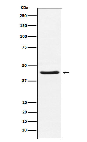 Anti-HSD3B1 Rabbit Monoclonal Antibody Boster Bio