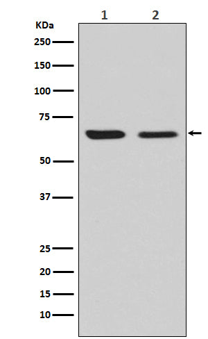 Anti-CRMP2 Rabbit Monoclonal Antibody Boster Bio