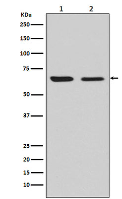 Anti-CRMP2 Rabbit Monoclonal Antibody Boster Bio
