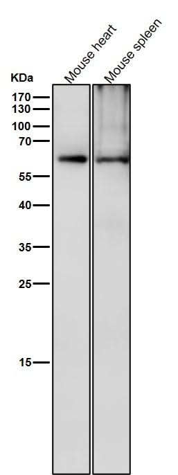 Anti-Phospho-CRMP2 (T514) Rabbit Monoclonal Antibody Boster Bio