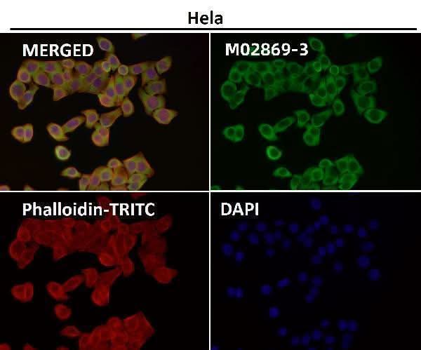 Anti-CD223 Rabbit Monoclonal Antibody Boster Bio