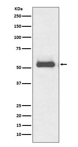 Anti-TRK fused gene TFG Rabbit Monoclonal Antibody Boster Bio