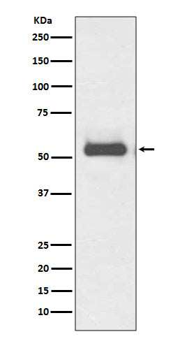 Anti-TRK fused gene TFG Rabbit Monoclonal Antibody Boster Bio