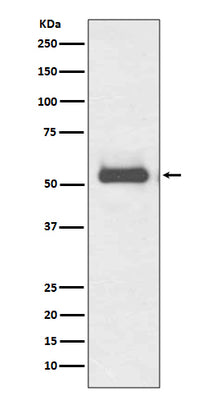 Anti-TRK fused gene TFG Rabbit Monoclonal Antibody Boster Bio