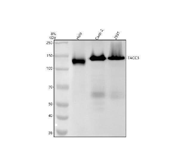 Anti-TACC3 Rabbit Monoclonal Antibody Boster Bio