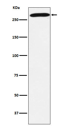 Anti-PRPF8 Rabbit Monoclonal Antibody Boster Bio