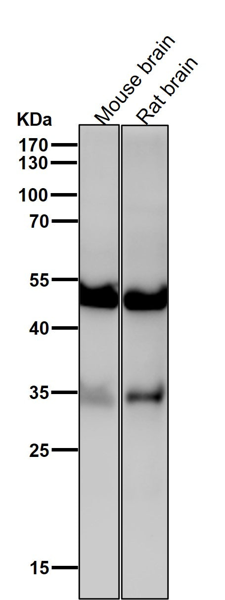 Anti-ACVR1B Rabbit Monoclonal Antibody Boster Bio