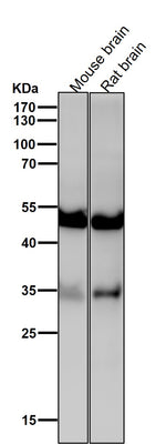 Anti-ACVR1B Rabbit Monoclonal Antibody Boster Bio