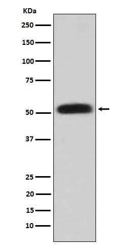 Anti-Glycerol kinase Rabbit Monoclonal Antibody Boster Bio
