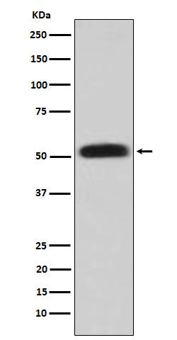 Anti-Glycerol kinase Rabbit Monoclonal Antibody Boster Bio