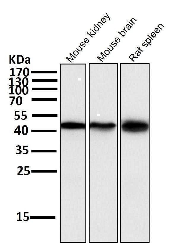 Anti-Atg4B Rabbit Monoclonal Antibody Boster Bio