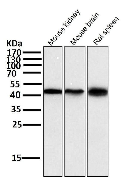 Anti-Atg4B Rabbit Monoclonal Antibody Boster Bio