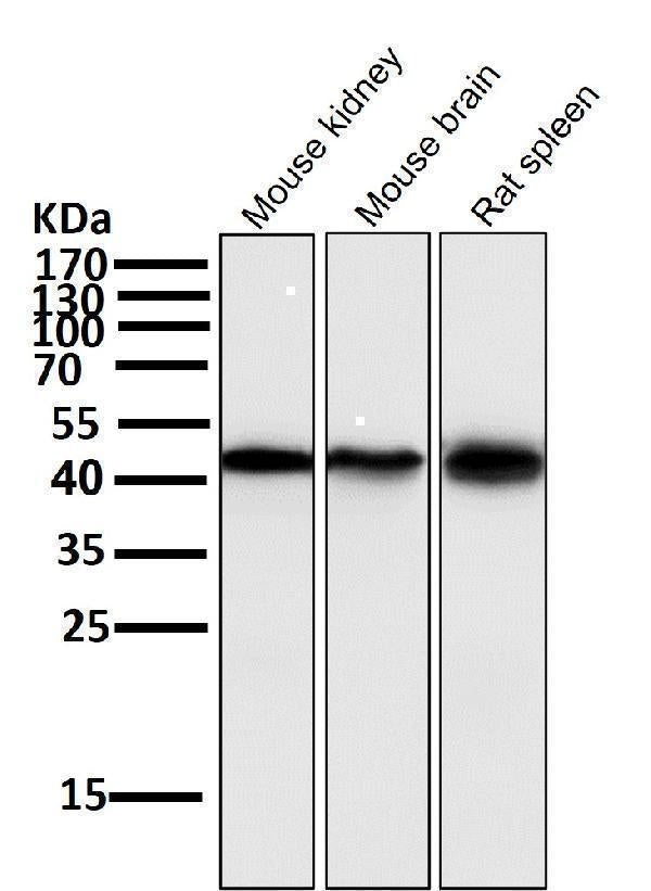 Anti-Atg4B Rabbit Monoclonal Antibody Boster Bio