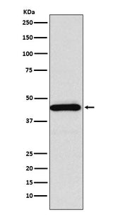 Anti-SSTR5 Rabbit Monoclonal Antibody Boster Bio
