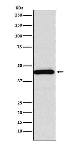 Anti-SSTR5 Rabbit Monoclonal Antibody Boster Bio