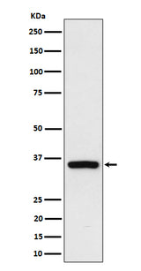 Anti-Rad51D Rabbit Monoclonal Antibody Boster Bio