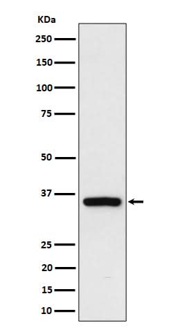 Anti-Rad51D Rabbit Monoclonal Antibody Boster Bio