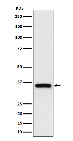 Anti-Rad51D Rabbit Monoclonal Antibody Boster Bio