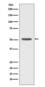 Anti-E2F2 Rabbit Monoclonal Antibody Boster Bio
