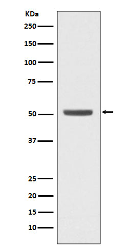 Anti-E2F2 Rabbit Monoclonal Antibody Boster Bio