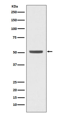 Anti-E2F2 Rabbit Monoclonal Antibody Boster Bio
