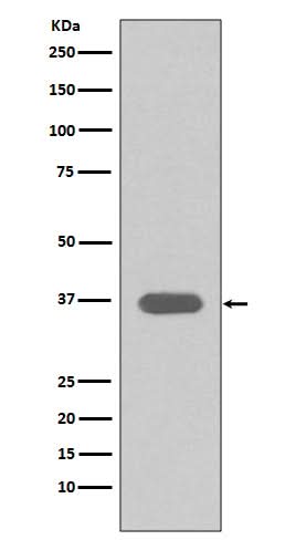 Anti-MSI2/Musashi 2 Rabbit Monoclonal Antibody Boster Bio