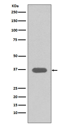 Anti-MSI2/Musashi 2 Rabbit Monoclonal Antibody Boster Bio