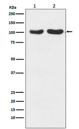 Anti-GluR2+GluR3 Rabbit Monoclonal Antibody Boster Bio