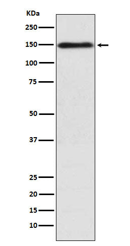 Anti-COL11A1 Rabbit Monoclonal Antibody Boster Bio