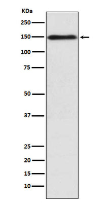 Anti-COL11A1 Rabbit Monoclonal Antibody Boster Bio