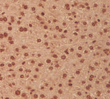 Anti-MEK3 MAP2K3 Rabbit Monoclonal Antibody Boster Bio