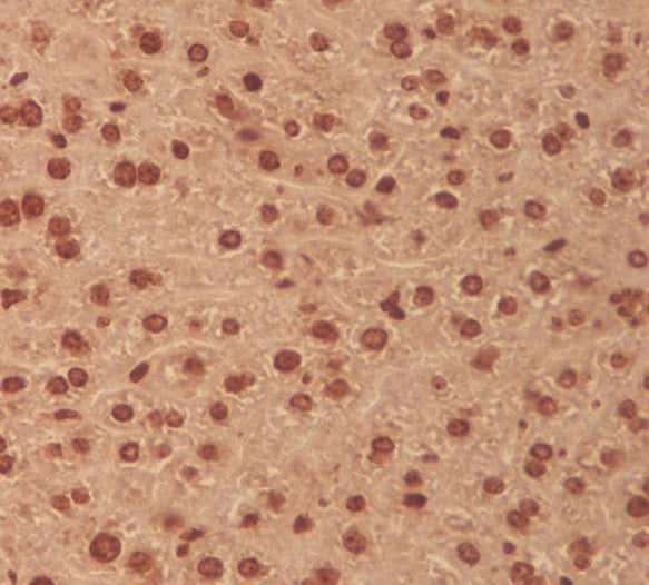 Anti-MEK3 MAP2K3 Rabbit Monoclonal Antibody Boster Bio