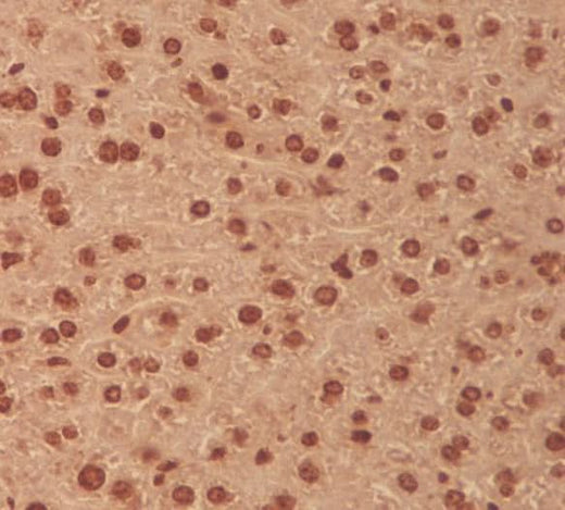 Anti-MEK3 MAP2K3 Rabbit Monoclonal Antibody Boster Bio
