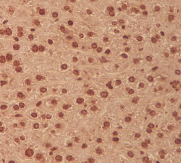 Anti-MEK3 MAP2K3 Rabbit Monoclonal Antibody Boster Bio