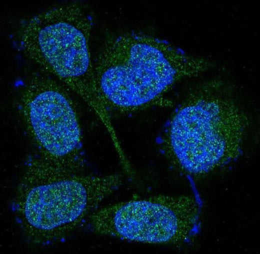 Anti-MEK3/MEK6 MAP2K3 Rabbit Monoclonal Antibody Boster Bio