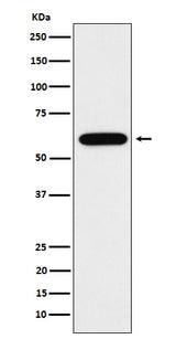 Anti-TUB1 Rabbit Monoclonal Antibody Boster Bio