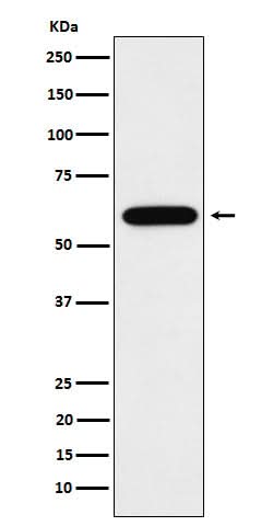 Anti-TUB1 Rabbit Monoclonal Antibody Boster Bio
