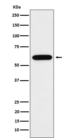 Anti-TUB1 Rabbit Monoclonal Antibody Boster Bio