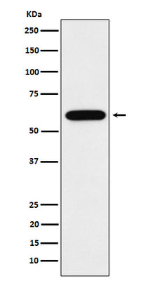 Anti-TUB1 Rabbit Monoclonal Antibody Boster Bio