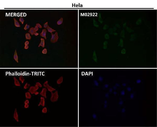 Anti-AGR2/Ag 2 Rabbit Monoclonal Antibody Boster Bio