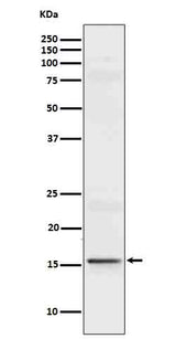 Anti-IL9 Rabbit Monoclonal Antibody Boster Bio
