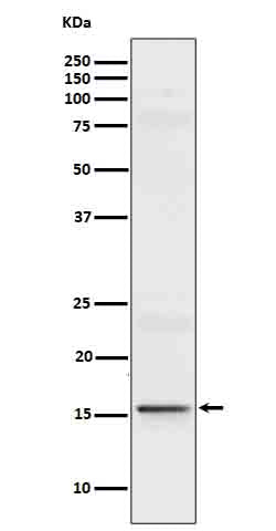 Anti-IL9 Rabbit Monoclonal Antibody Boster Bio