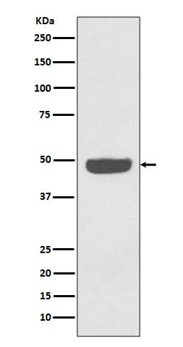 Anti-NSE ENO2 Rabbit Monoclonal Antibody Boster Bio