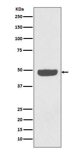 Anti-NSE ENO2 Rabbit Monoclonal Antibody Boster Bio